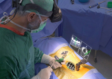 Le casque Xvision d'Augmedics