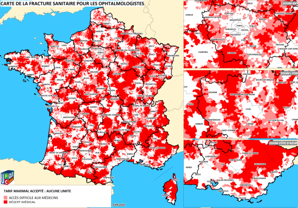 carte_ophta_fracture_santiaure_ufc.png