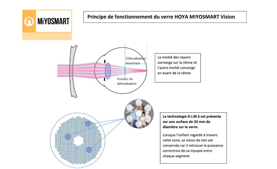 Principe de fonctionnement du verre Miyosmart Vision