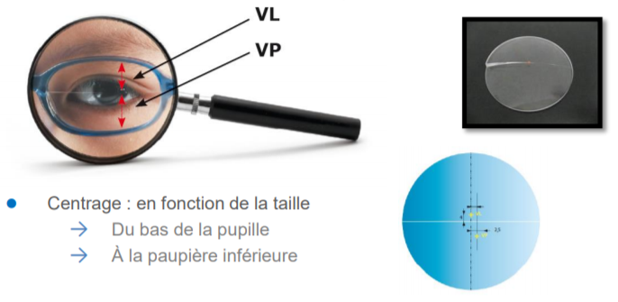 Myopilux Max - Essilor