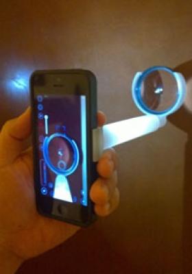 Un adaptateur pour Smartphone permet aux ophtalmologistes de réaliser des tests visuels
