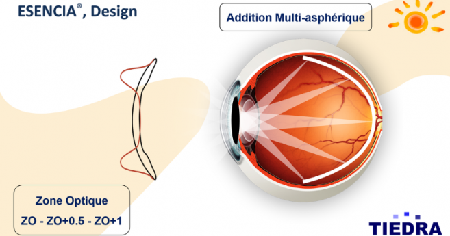 Esencia Toric une nouvelle lentille souple pour astigmates qui contrôle l’évolution de la myopie