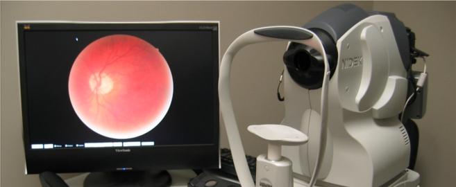 Une étude confirme la pertinence du test de la vue pour prévenir les AVC