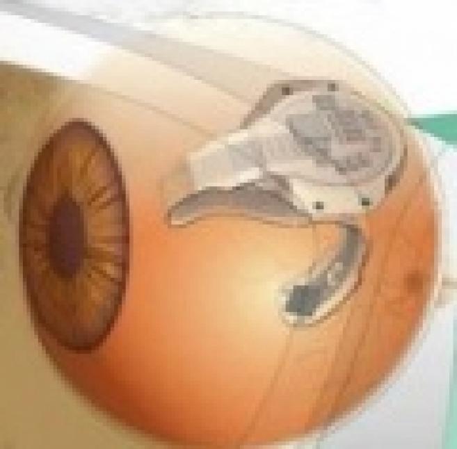 Œil bionique : le premier système de vision artificielle pourrait être commercialisé en 2011