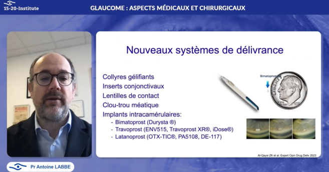 Glaucome : vers une révolution des traitements médicaux