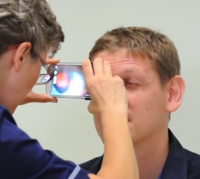Peek Retina : une application mobile pour la détection des problèmes oculaires 