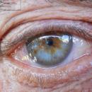 Détecter la maladie d’Alzheimer grâce à un examen ophtalmologique 
