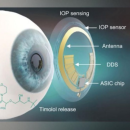 Corée : des chercheurs créent une lentille pour traiter le glaucome