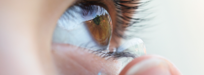 L'arrêt du port des lentilles de freination de la myopie ne provoque pas d'effet rebond, selon une étude