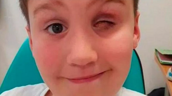 Un enfant perd son œil à cause d'un pistolet à fléchettes