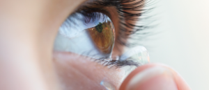 L'arrêt du port des lentilles de freination de la myopie ne provoque pas d'effet rebond, selon une étude