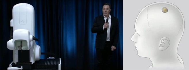 elon_musk_neuralink.jpg