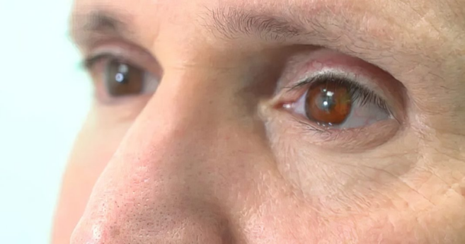 prothese_oculaire.png