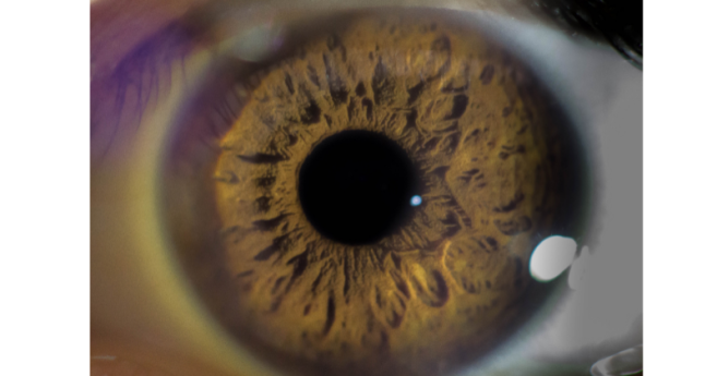 etude_jama_covid_occlusions.png