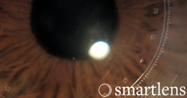 smartlens_milens_header.png