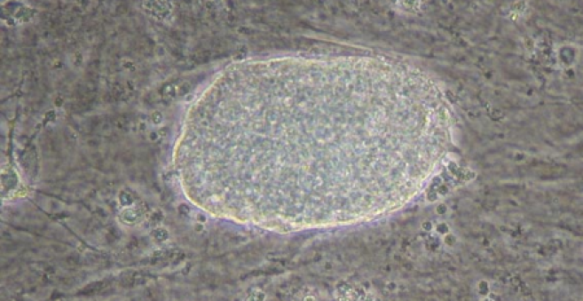 cellulesouch1.png