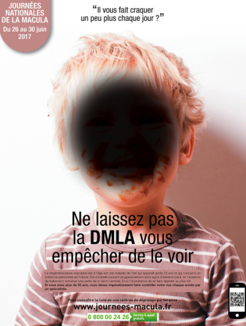 macula.png
