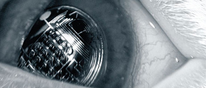 lentille_electronique.jpg