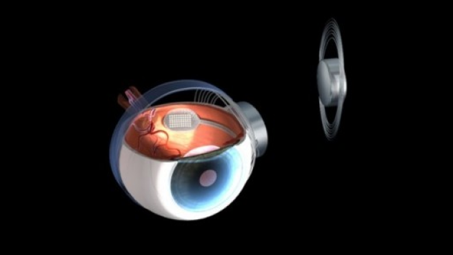 argus_ii.png