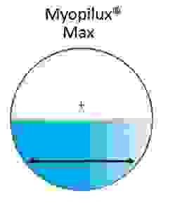Myopilux Max - Essilor
