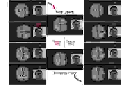 Le zoom et le dézoom peuvent être contrôlés par un double clignement des yeux&nbsp;