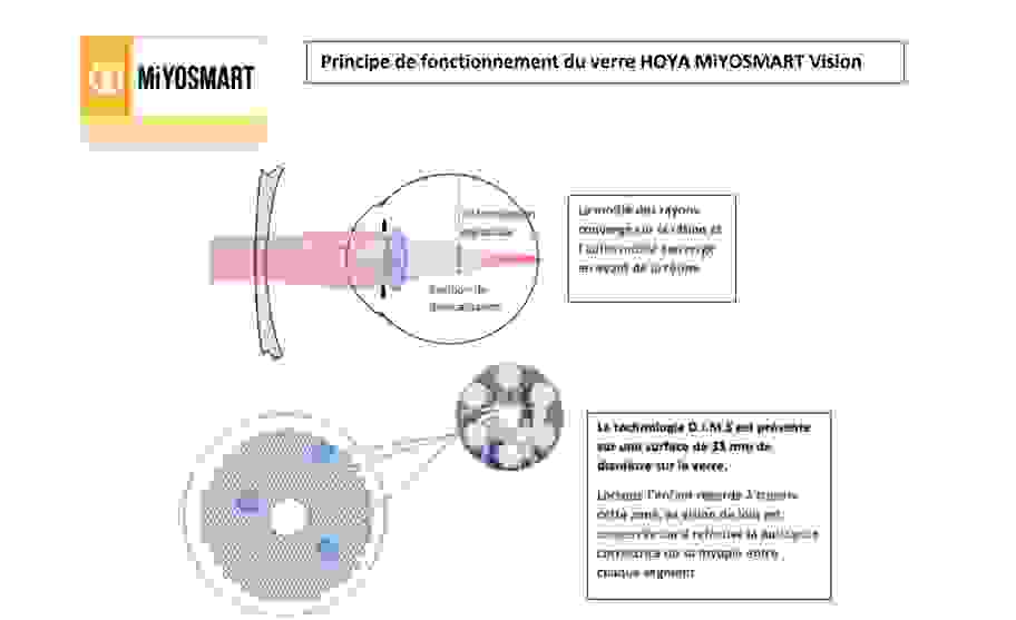 Principe de fonctionnement du verre Miyosmart Vision