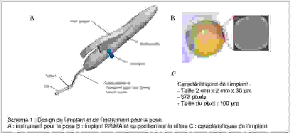 Pixium Vision