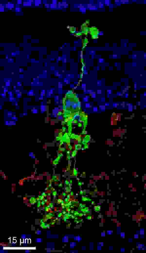 Cellule de Campana