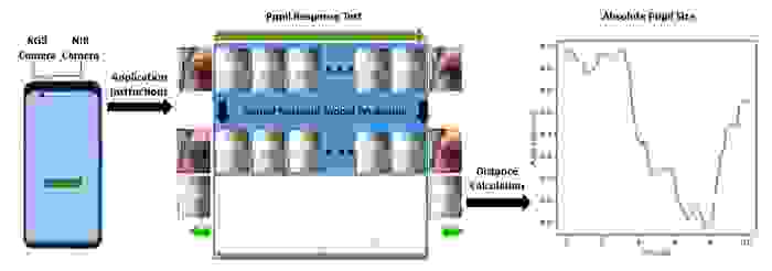 lutilisateur_effectue_un_test_de_reponse_pupillaire._les_donnees_sont_ensuite_collectees_pour_calculer_la_distance_et_le_diametre_de_la_pupille.png