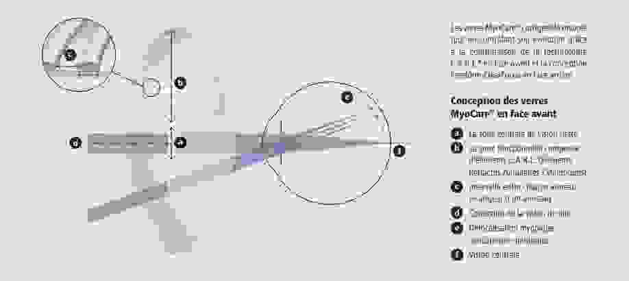 zeiss_myocare.png