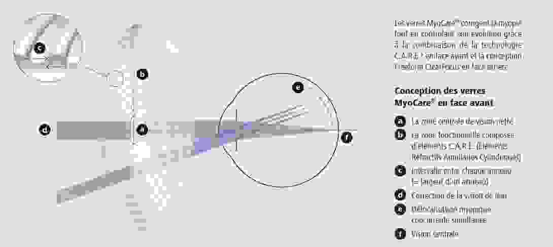zeiss_myocare.png