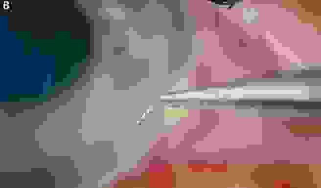 piqure_2.jpg