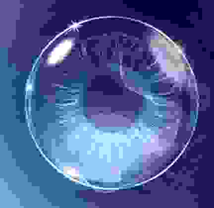 binova_i-shape_sclerale.png