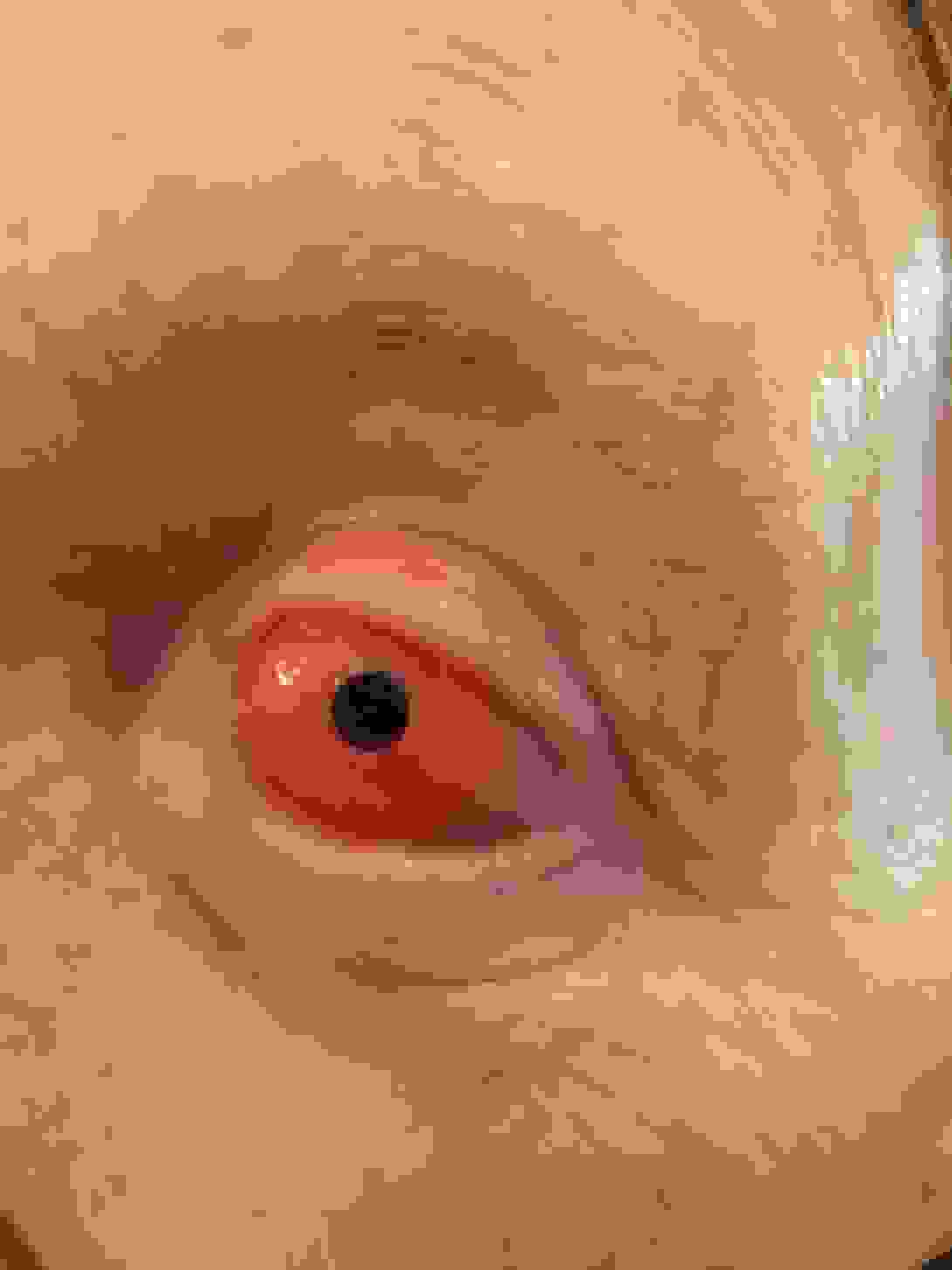 ookp_eye_surgery_tooth.jpeg