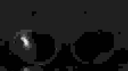 para.png
