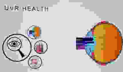 technologieuvprotect.png